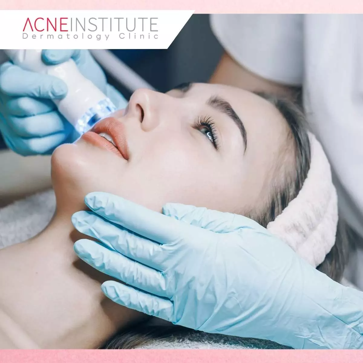 Mengenal Treatment MRF Acne Institute Jakarta