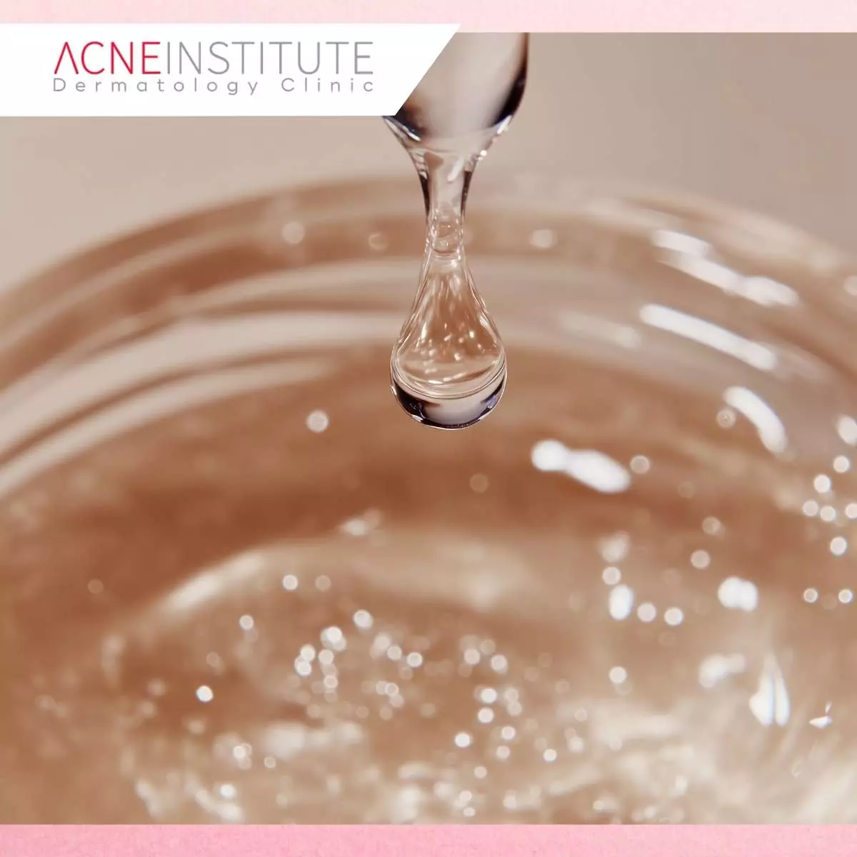 Mengapa Kulit Sensitif Memerlukan Acne Serum Khusus