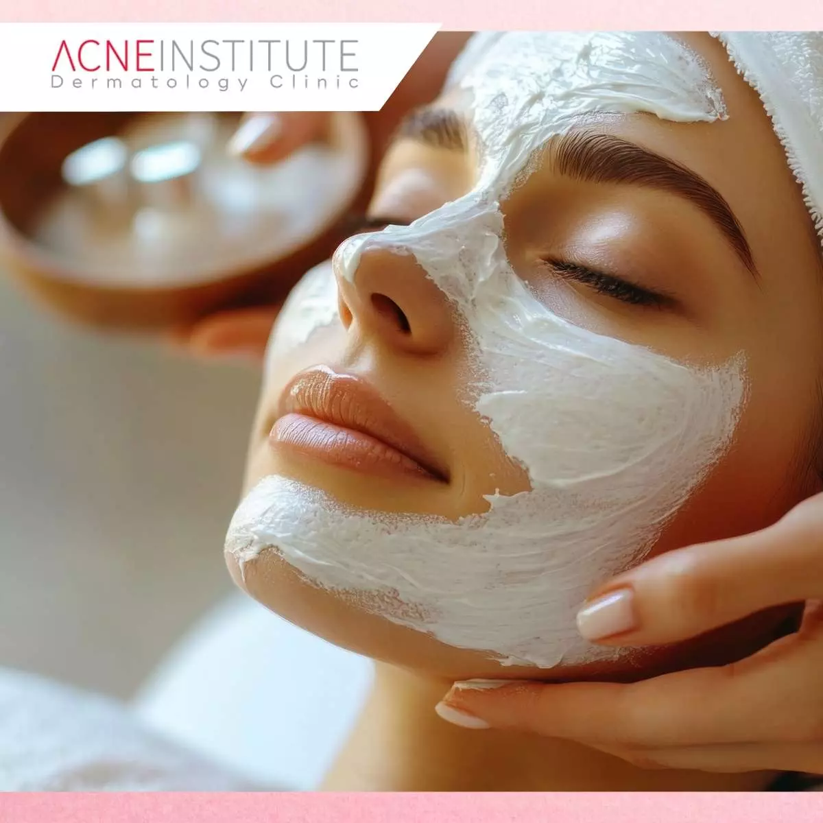 Manfaat Acne Serum AIC untuk Kulit Sensitif
