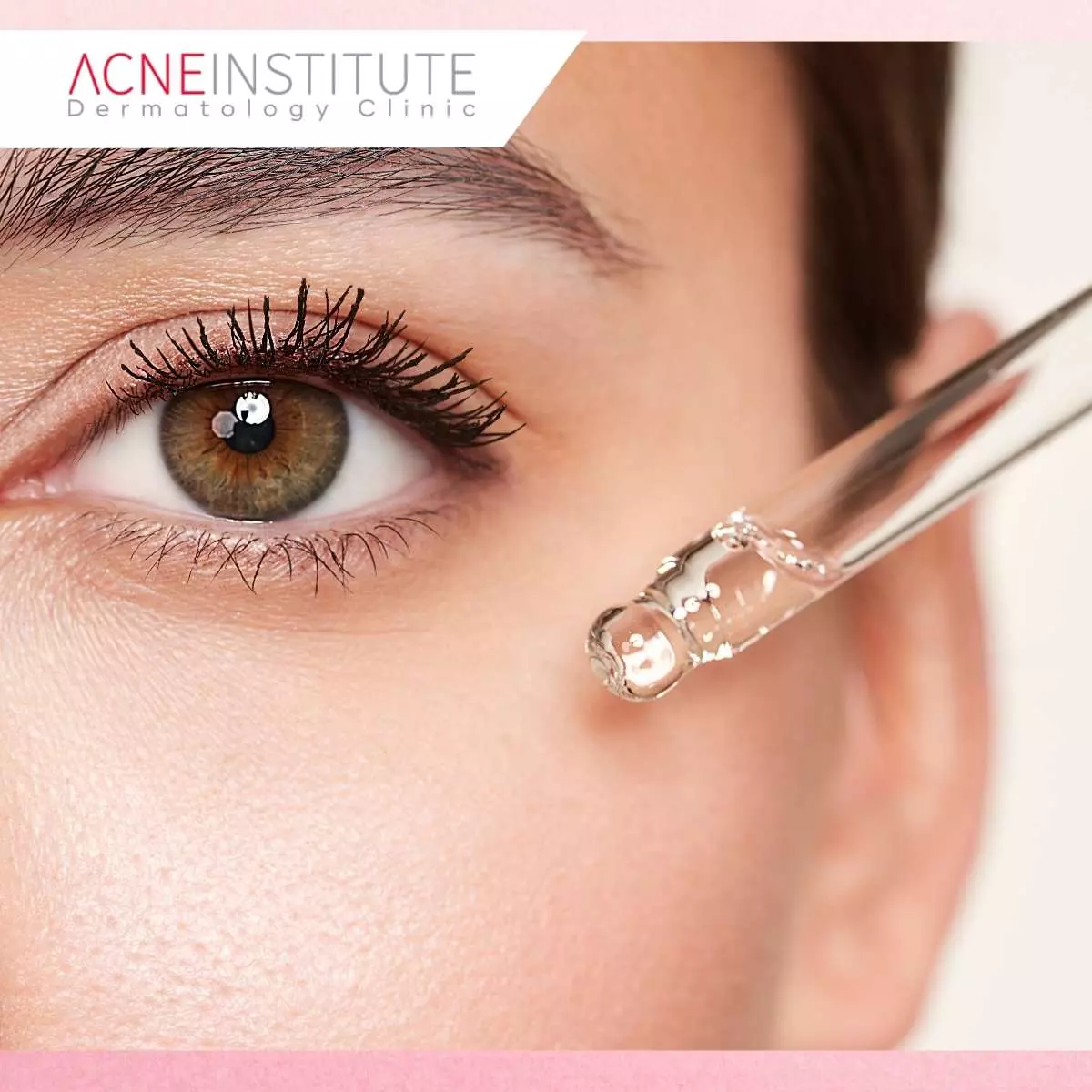 Cara Menggunakan Acne Serum AIC dengan Benar