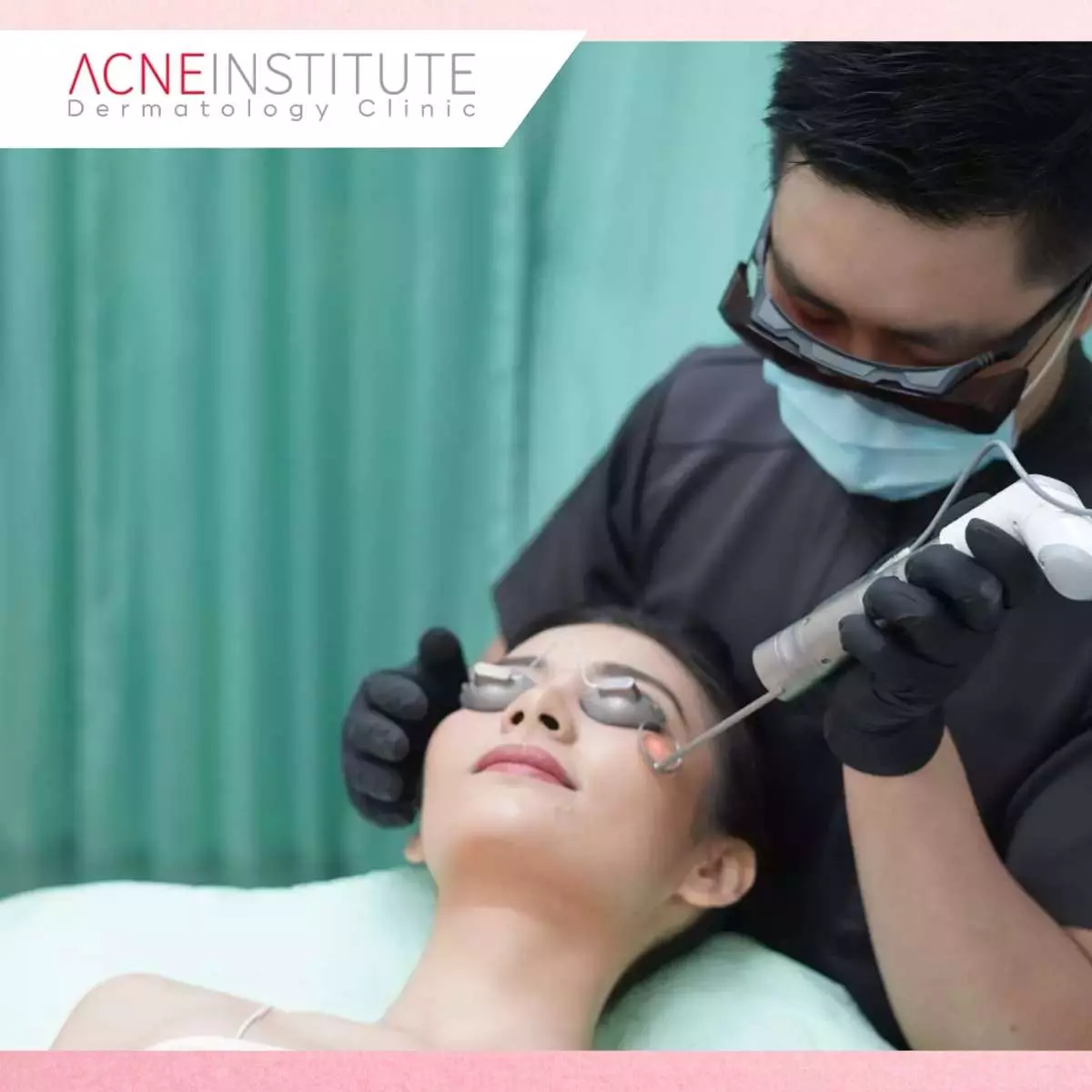 Apa Itu Treatment NBeam di Acne Institute?