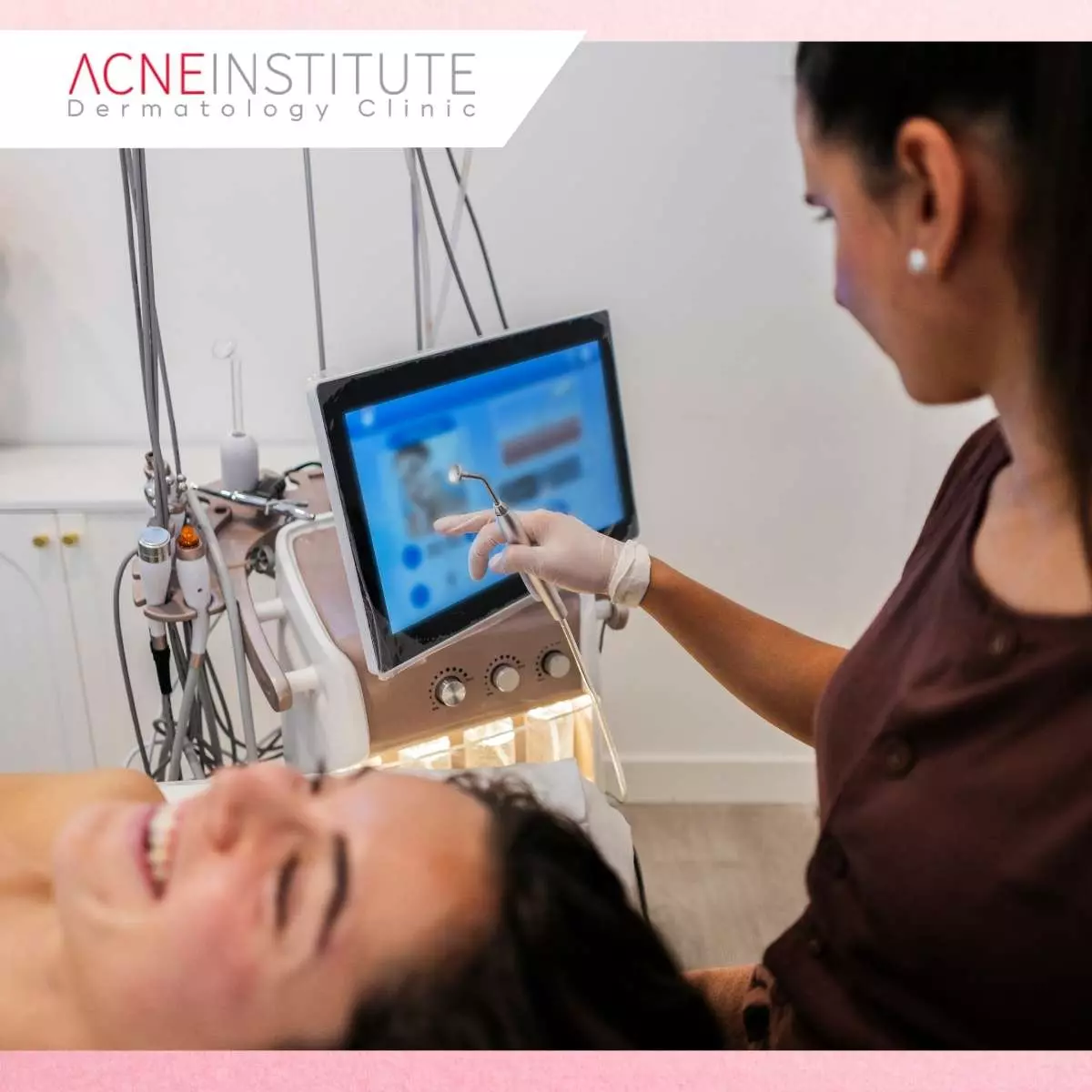 Keunggulan Treatment Bekas Jerawat PIH di Acne Institute