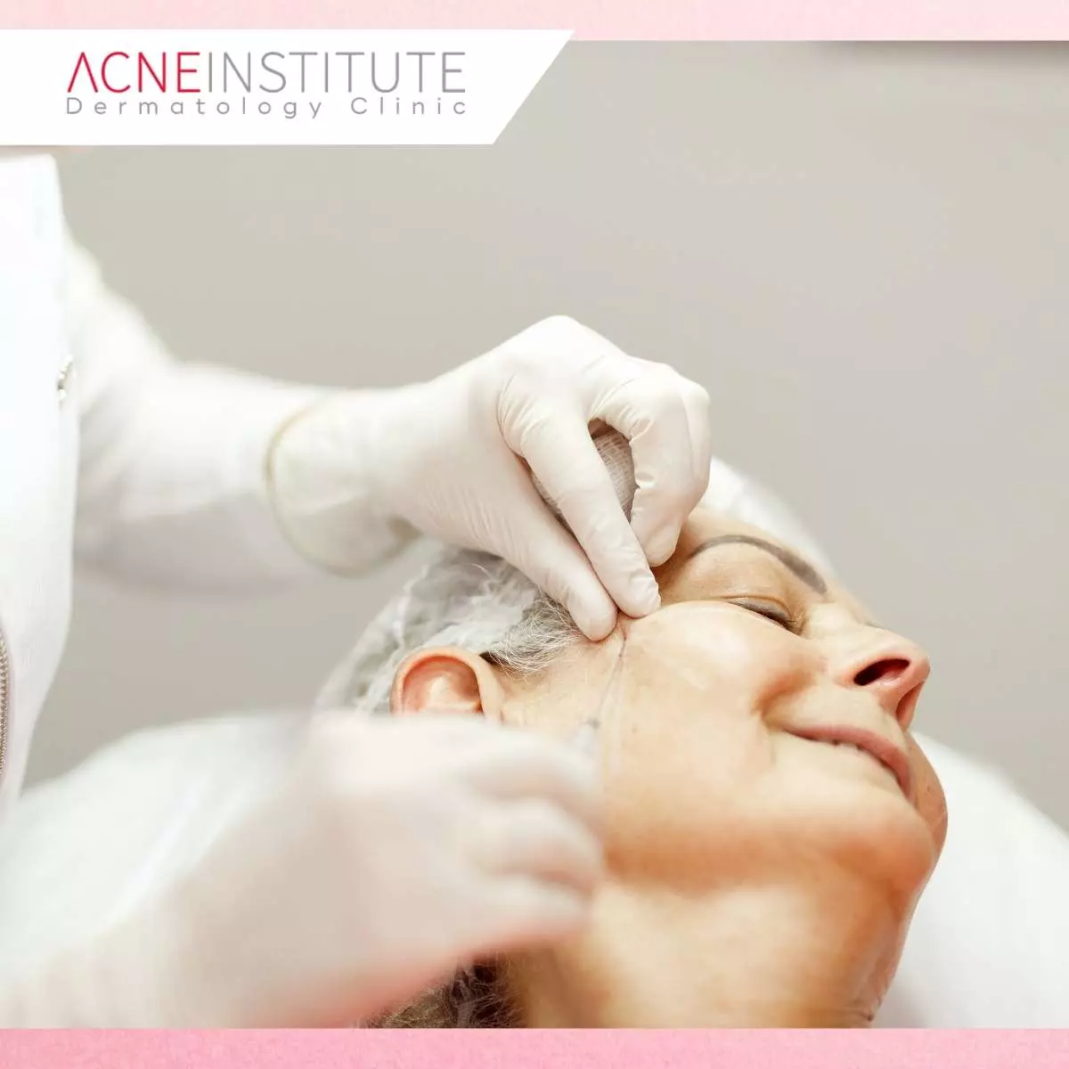 Mengapa Hasil Treatment Bisa Bertahan Lebih dari 3 Bulan