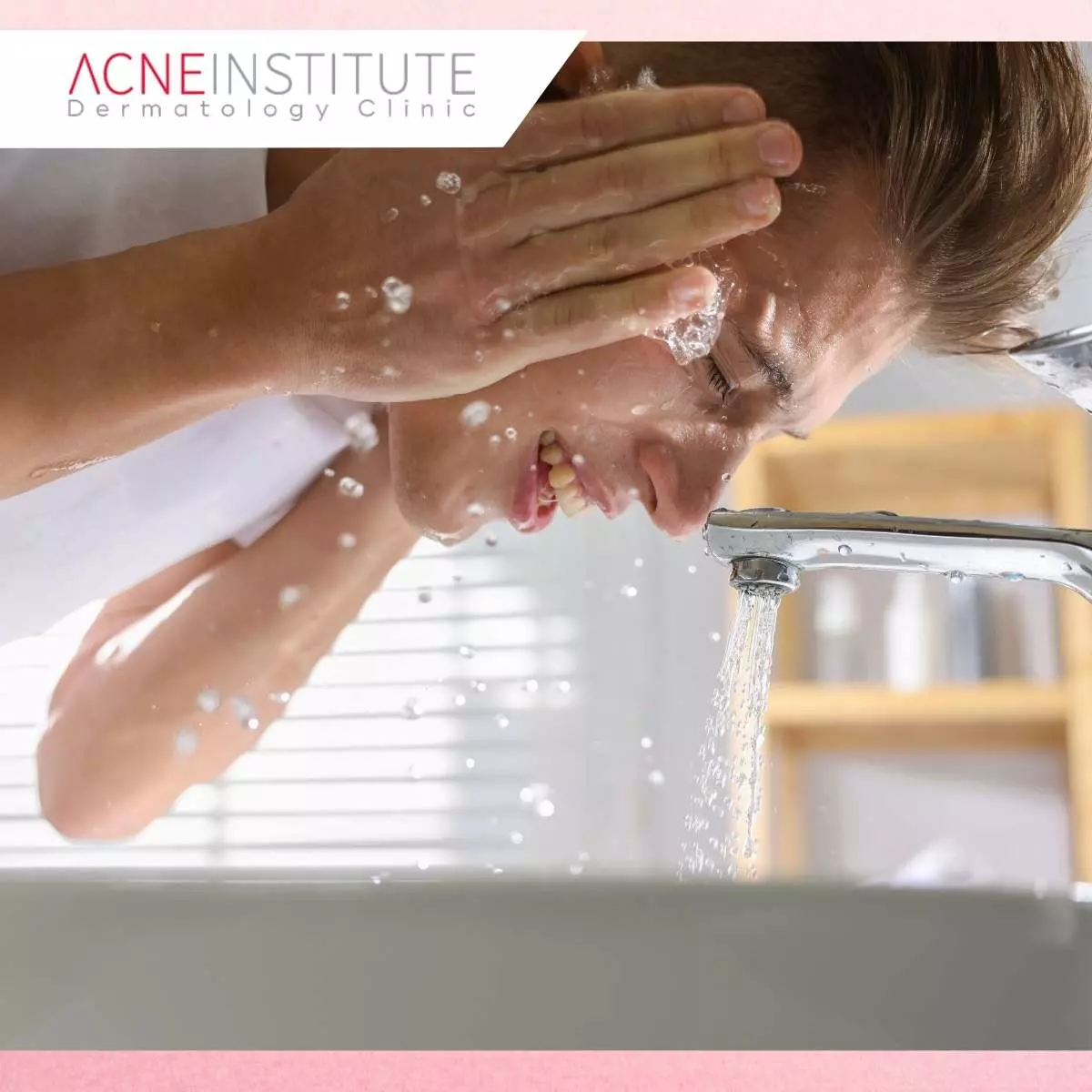 Tips Mendukung Hasil Treatment Jerawat Pria