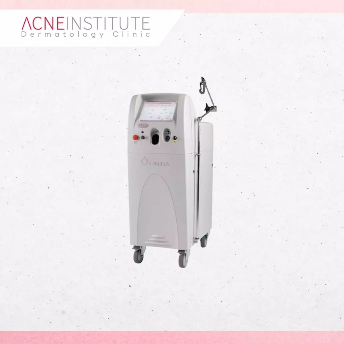 Mengenal Teknologi Laser Vbeam untuk Atasi Keloid