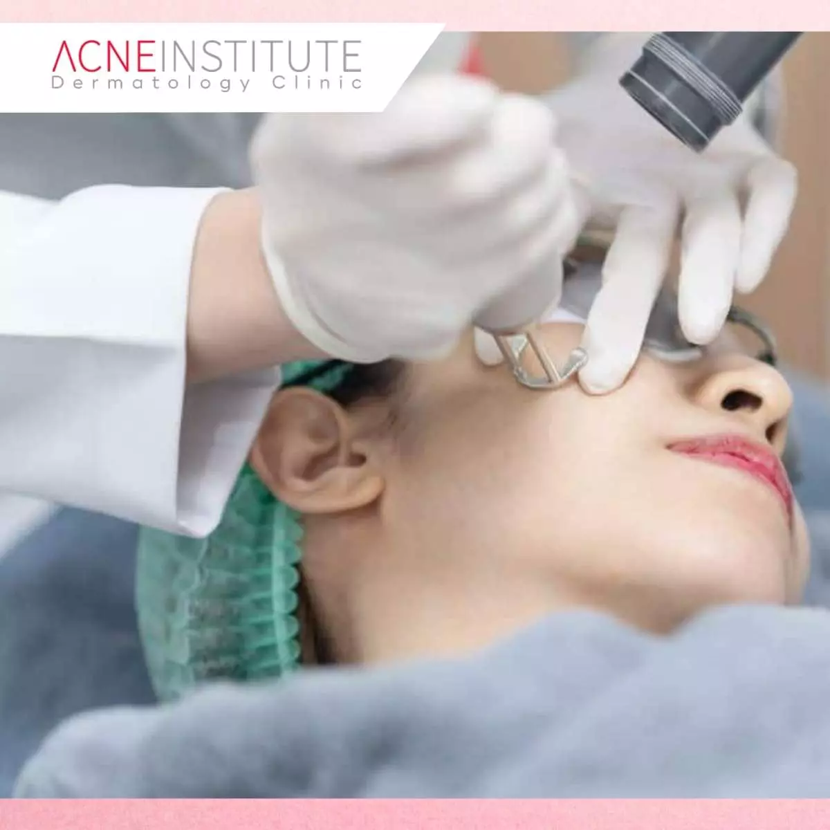 Berapa Kali Treatment Dibutuhkan?