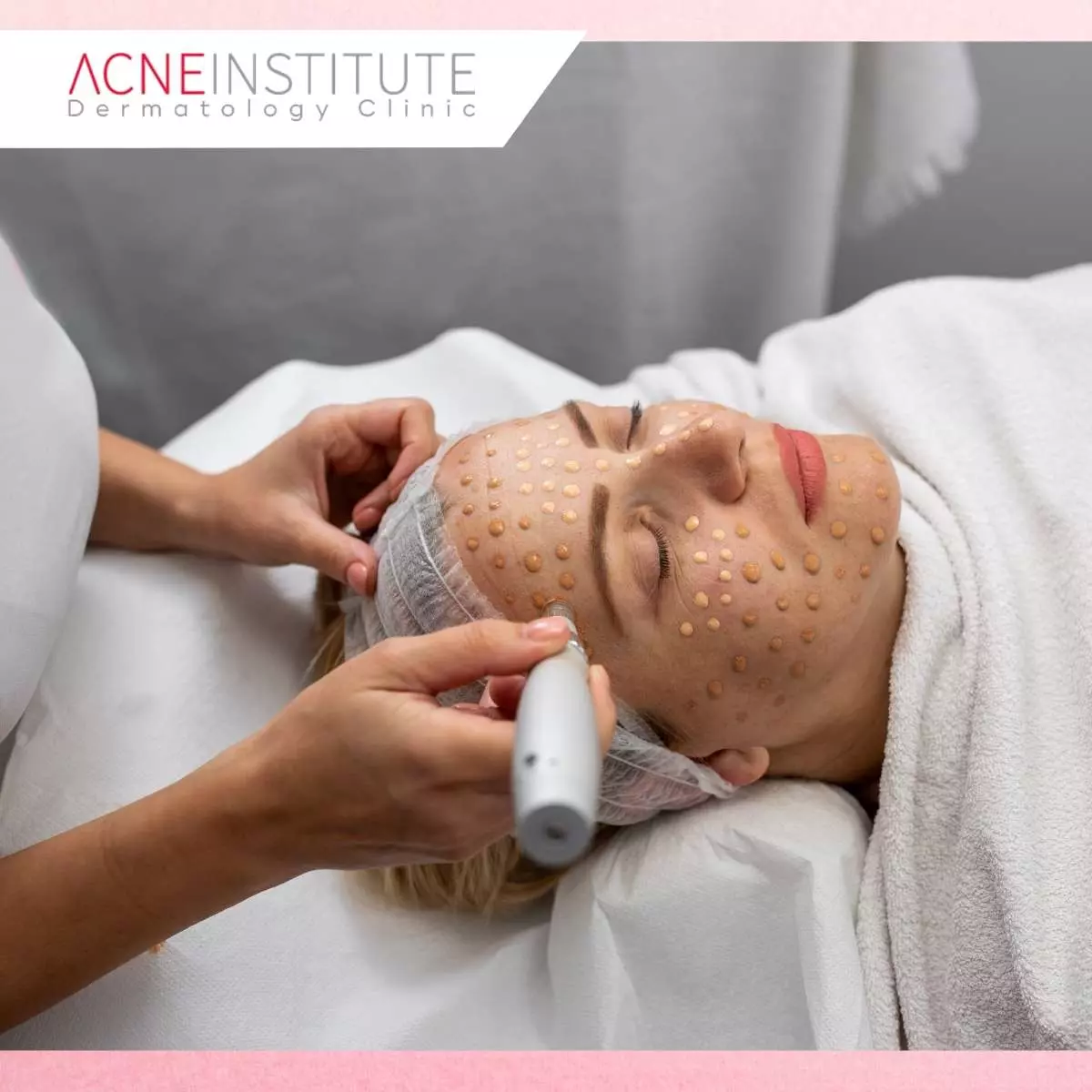 Apa Itu BB Glow Treatment?