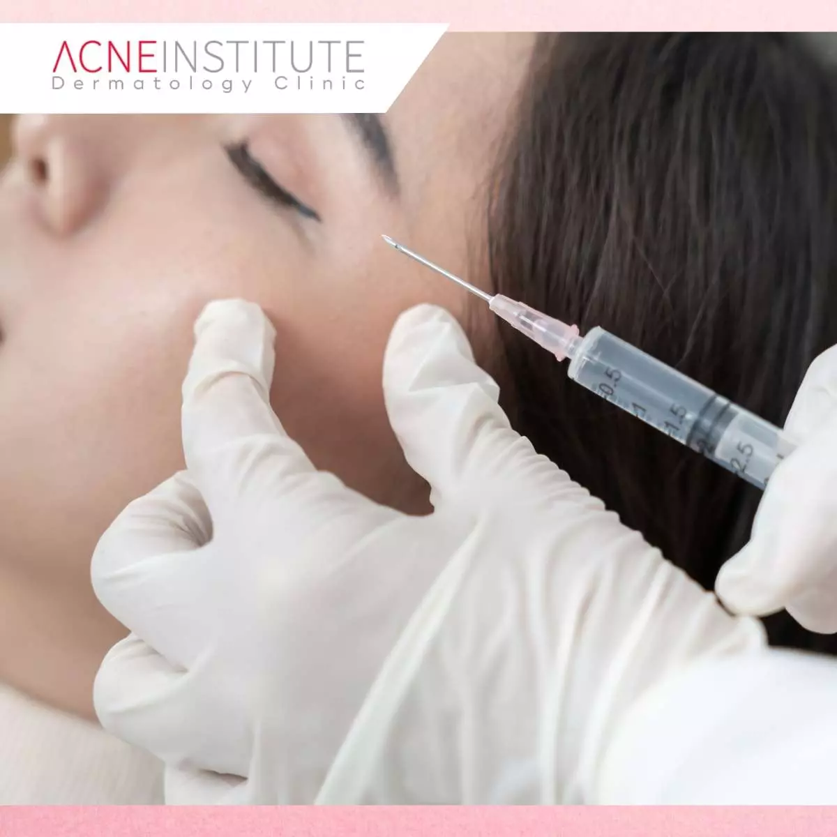 Jangan Salah Treatment! Ini Perbedaan Filler dan Botox yang Wajib Anda Tahu