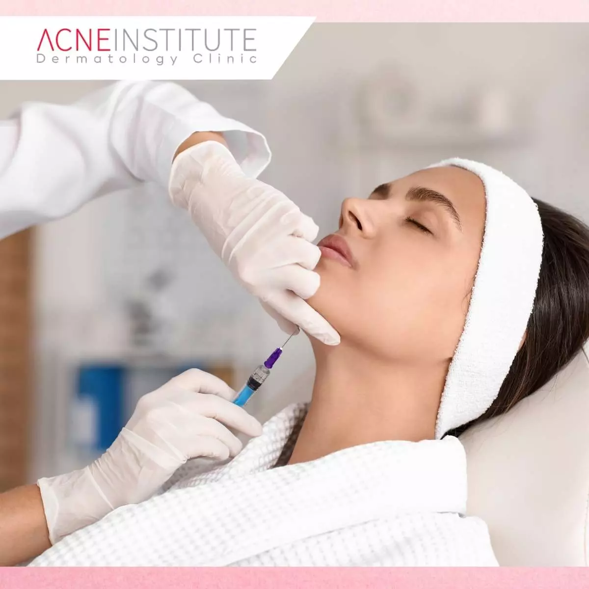 Tahapan Prosedur Filler Wajah Natural Look di Acne Institute