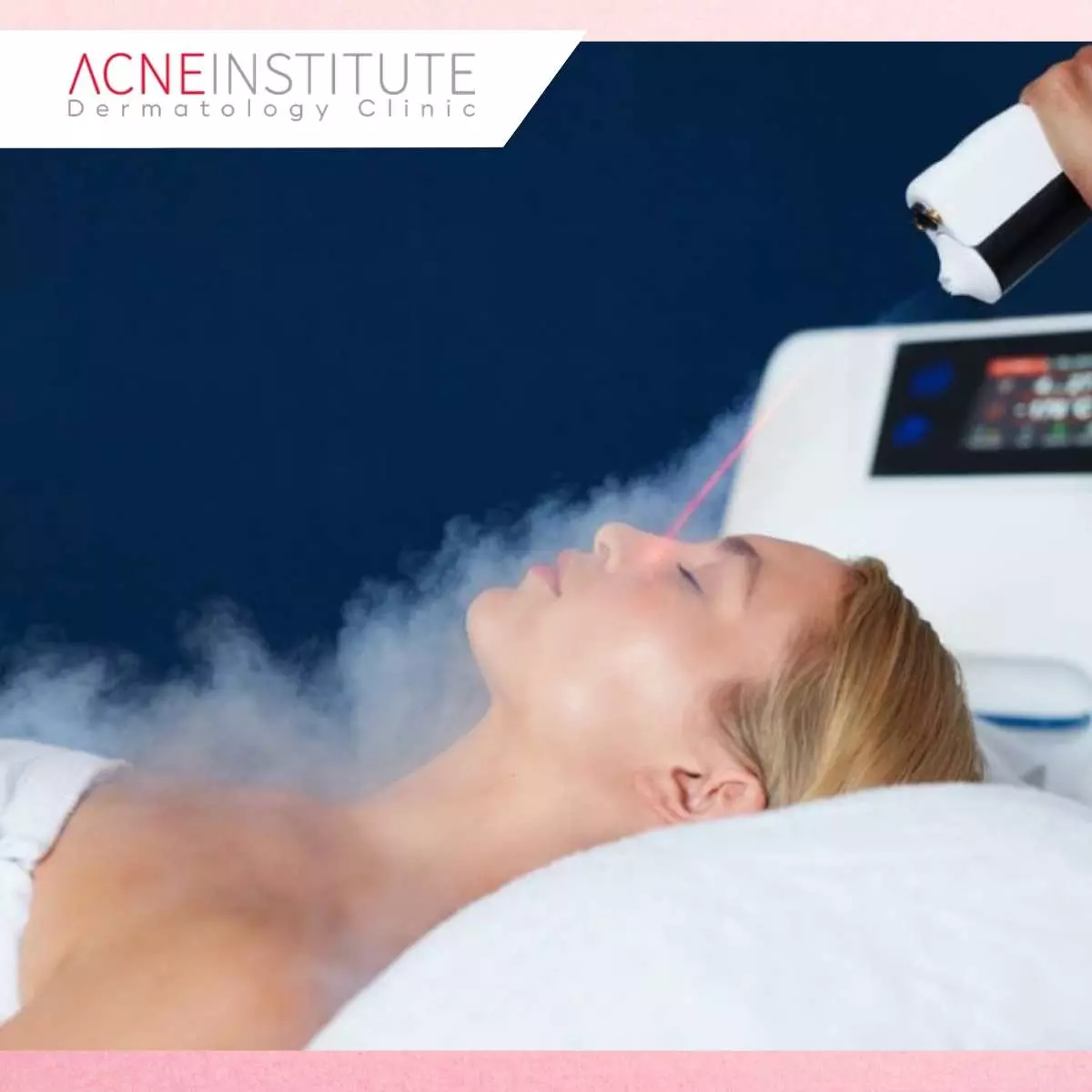 Apa Itu Cryofacial dan Bagaimana Cara Kerjanya?