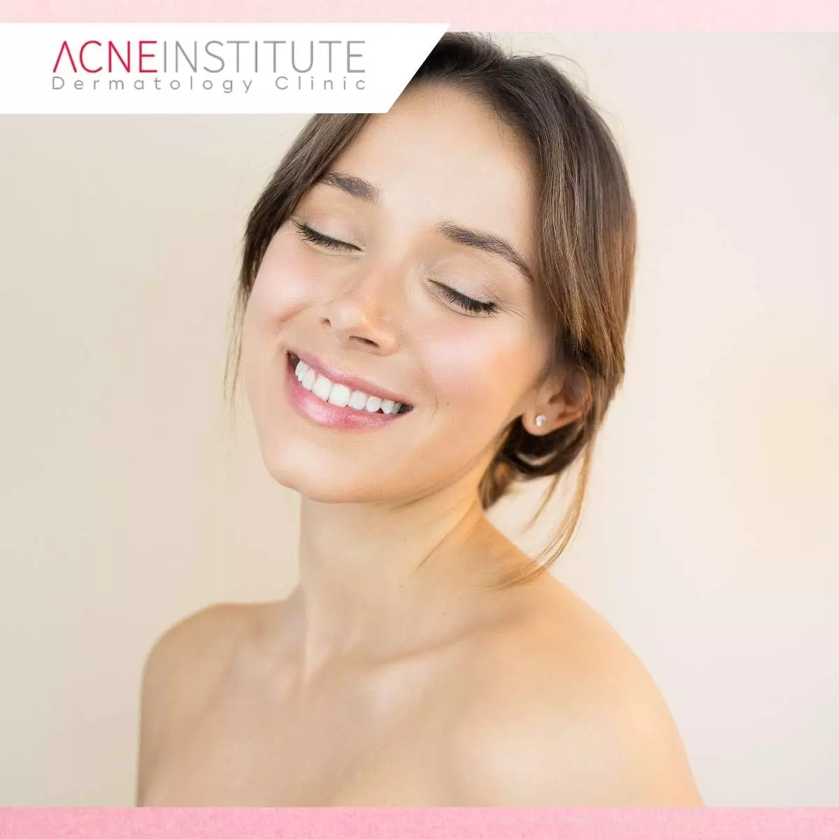 Prosedur Treatment Cryofacial di Acne Institute Surabaya