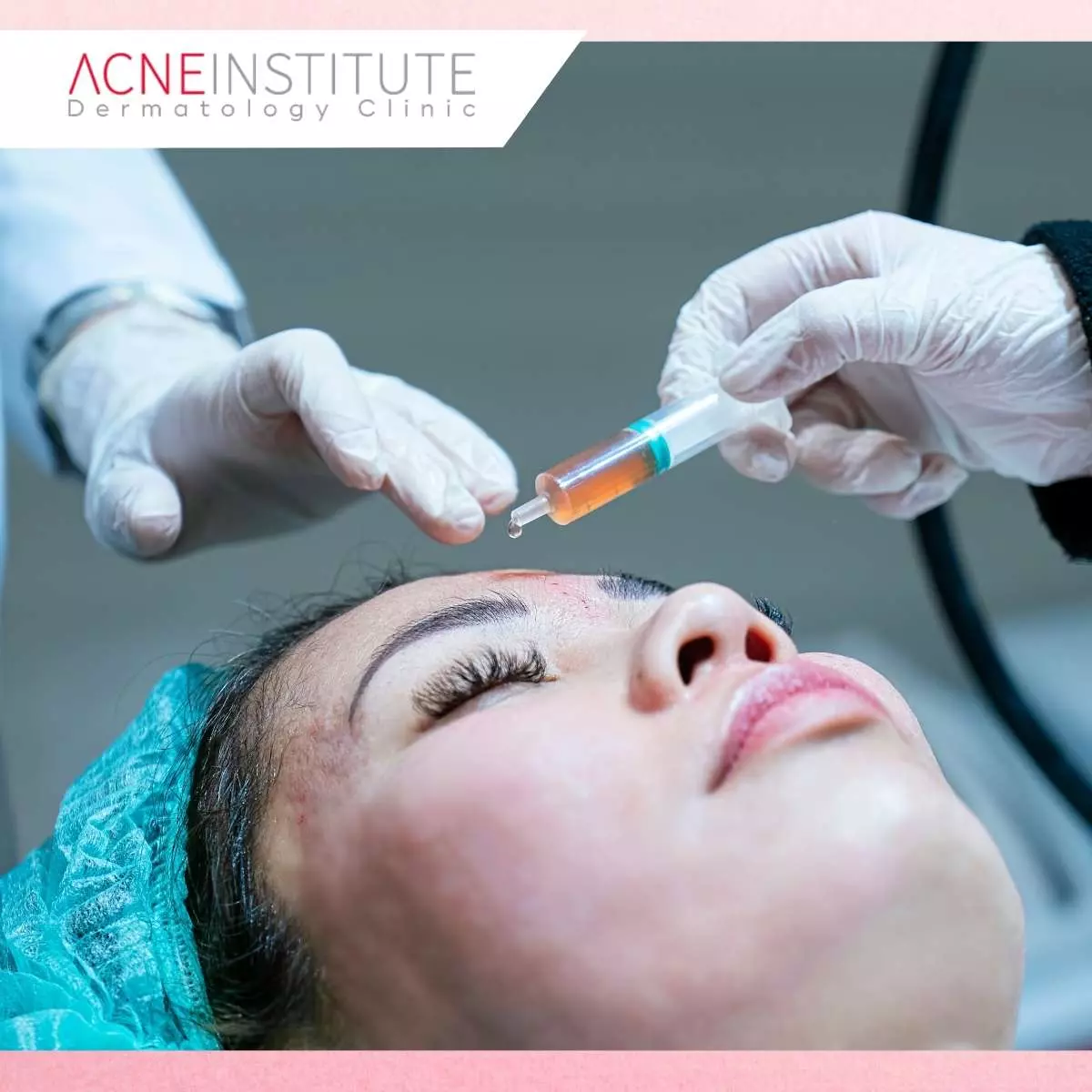 Cara Memilih Treatment Wajah yang Aman