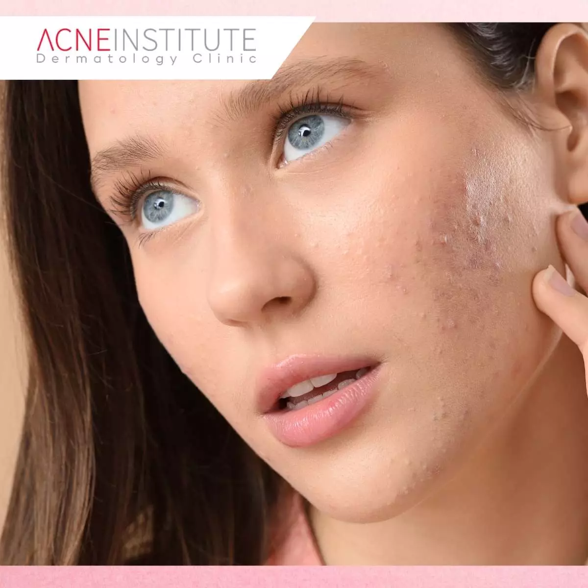 Tips Perawatan Setelah Non Invasif Treatment