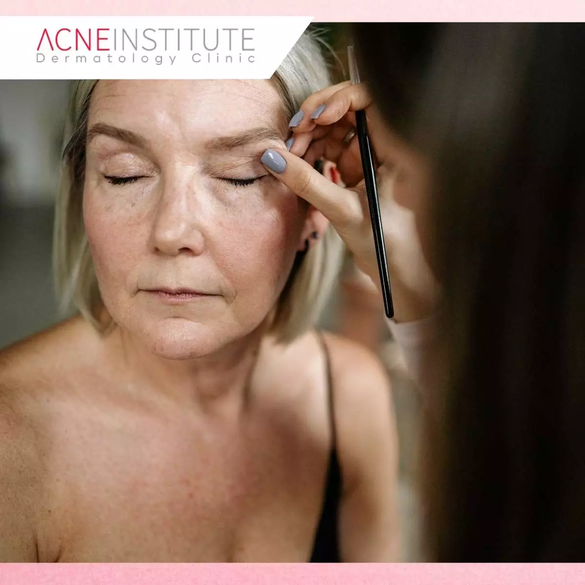 Treatment Anti Aging Penting untuk Kulit