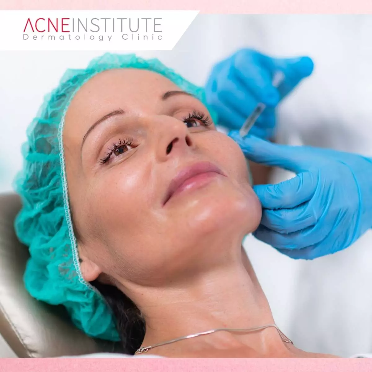 Keunggulan Treatment Anti Aging di Acne Institute