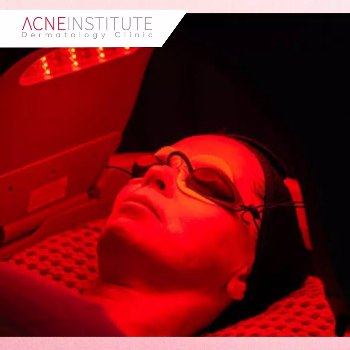 Dynamic Detox di Acne Institute