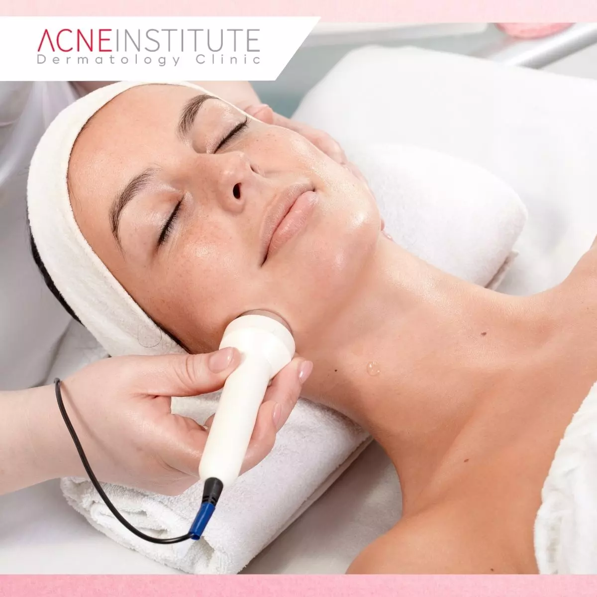 Bagaimana Proses Treatment Jerawat di Acne Institute Jakarta?