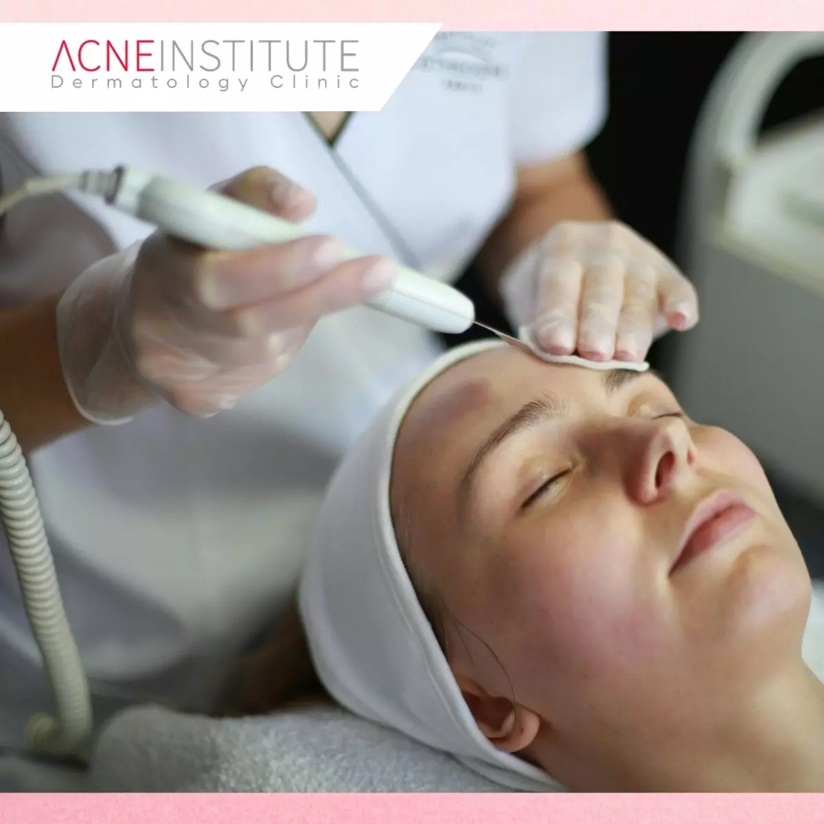 Tips Merawat Kulit di Rumah Selama Menjalani Kombinasi Treatment