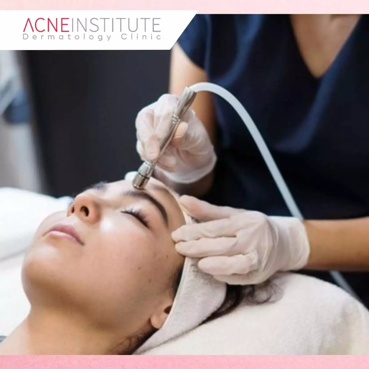 Area Wajah yang Umumnya Menjadi Fokus Collagen Stimulator