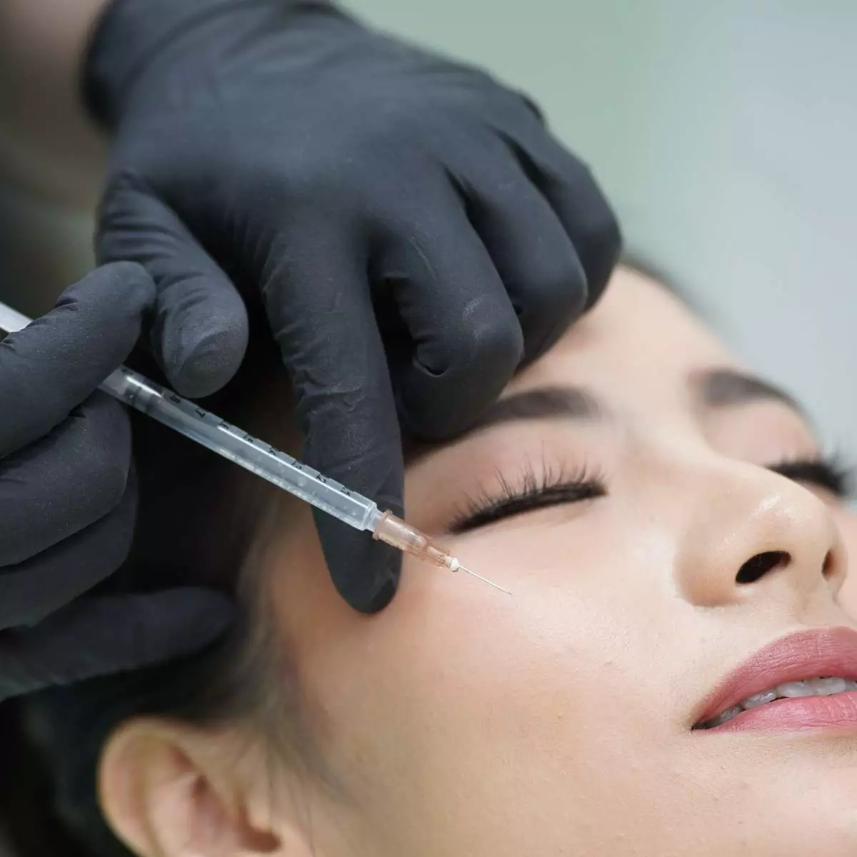 Acne Control Injection