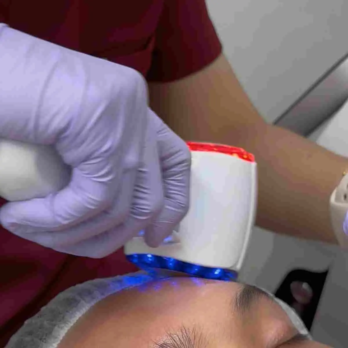 Cyrofacial
